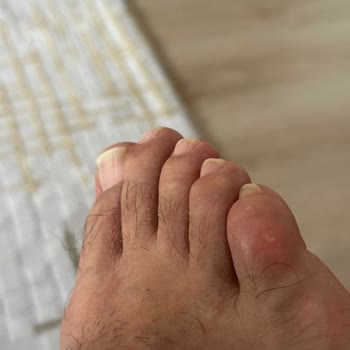 Sağ Ayakkabının Dar Kalıbı Kullanılamaz Duruma Getirdi, İade İstiyorum