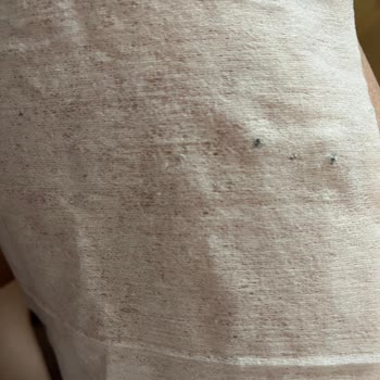Molfix Islak Mendilde Alüminyum Parçaları Güvenlik Endişesi Ve Ücret İadesi Talebi
