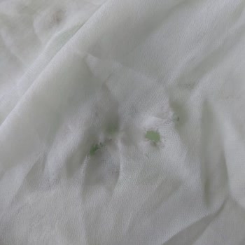 Zara’dan Gelen Yırtık Ve Lekeli Elbise İçin İade Ve Telafi Talebi