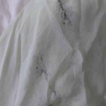 Zara’dan Gelen Yırtık Ve Lekeli Elbise İçin İade Ve Telafi Talebi