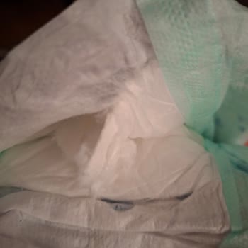 Ebebek Bebek Bezinde Sert Cisim Ve Sızdırma: Güvenlik Sorunu