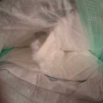 Ebebek Bebek Bezinde Sert Cisim Ve Sızdırma: Güvenlik Sorunu