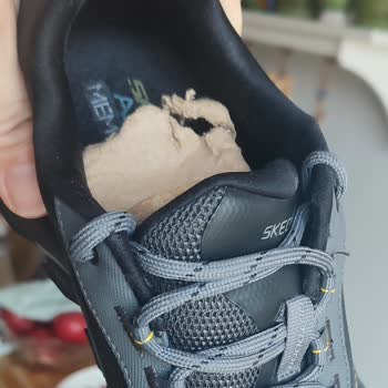 Kalitesiz Skechers Ayakkabısının Hızlı Deformasyonu Ve İade Talebi