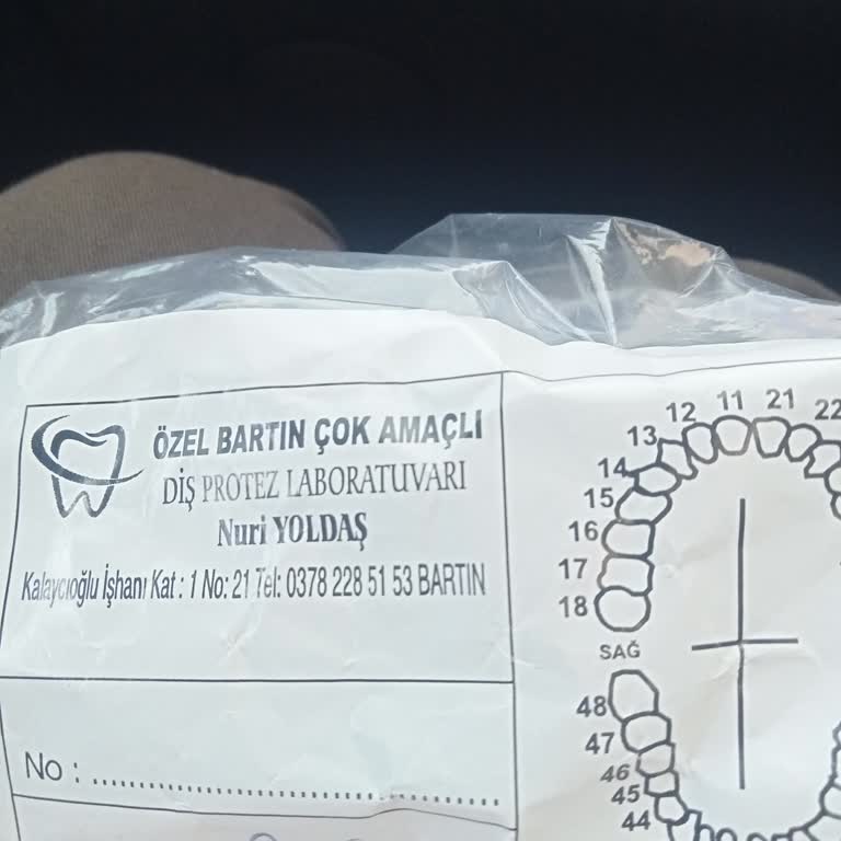 Kırıcı Tavır, Açıklama Eksikliği Ve Dolgu Sonrası Rahatsızlık