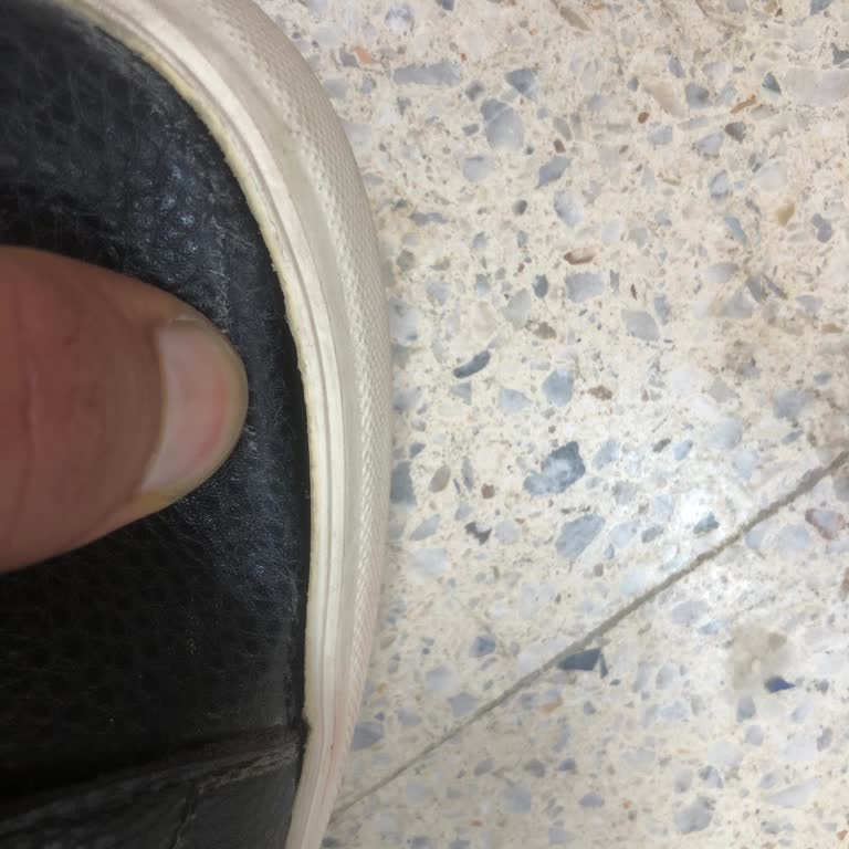 Tommy Ayakkabısının Kısa Sürede Açılması Ve Değişim Talebi