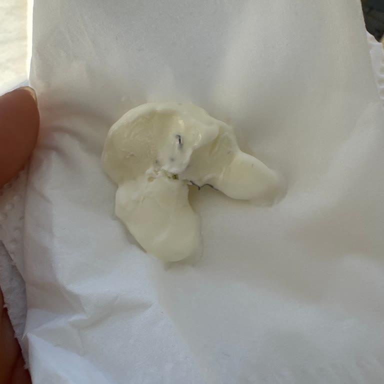 Cremeria Milano Dondurmalar Hem Bayattı Hem De Her Birinin İçinden Teker Teker Tel Çıktı