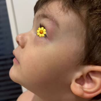 Oyun Bahçesi Anaokulu Çocuğumuzda Sürekli Yaralanmalar, Hijyen Eksikliği Ve Saygısız İletişim