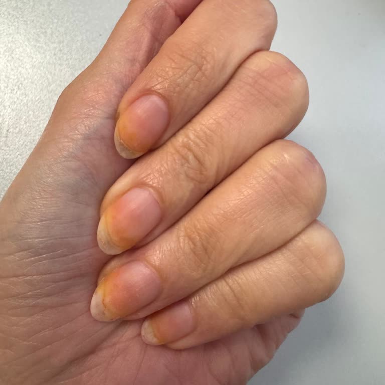 Pastel Oje Turuncuya Dönüştü, Kalıcı Renk Sorunu