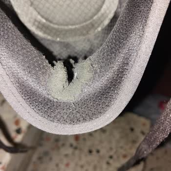 Skechers Topuk Yırtılması Ve Boyner'den Kullanıcı Hatası İddiası