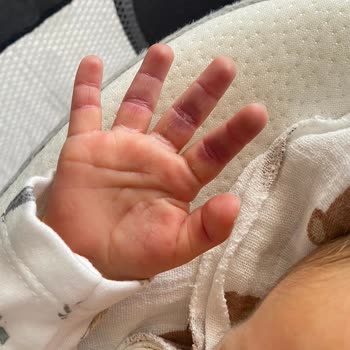 Bebek Elindeki Morluklar İçin Yoğun Bakımda Dikkatsiz Tutum Ve Açıklama Talebi