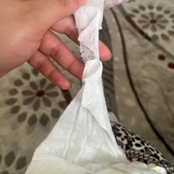 Molfix Bebek Bezlerinde Cırt Cırt Kopması Ve Sızıntı Sorunu