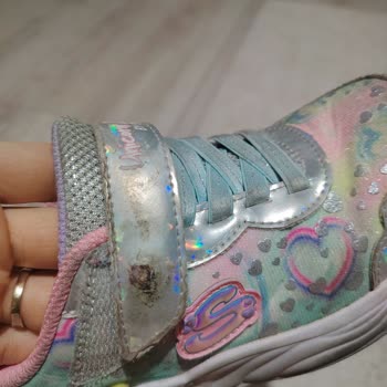 Skechers Çocuk Ayakkabısının Kısa Sürede Aşırı Yıpranması Ve Ücret İadesi Talebi