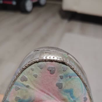 Skechers Çocuk Ayakkabısının Kısa Sürede Aşırı Yıpranması Ve Ücret İadesi Talebi