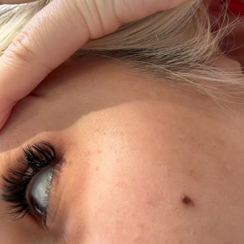 Melisa Diker Beauty Studio Sol Gözümü Tam Olarak Açamıyorum, Canım Acıyor
