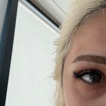 Melisa Diker Beauty Studio Sol Gözümü Tam Olarak Açamıyorum, Canım Acıyor