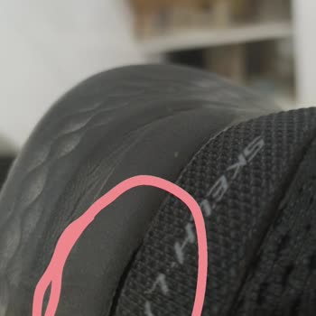 Skechers Ayakkabısının Üç Hafta Sonra Arka Birleşim Yerinden Yırtılması Ve Üretim Hatası İddiası