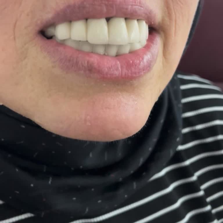 Dt. Egesu Özsoy Hem Sağlık Açısından Hem De Maddi Olarak Çok Ağır Bir Mağduriyet Yaşadık