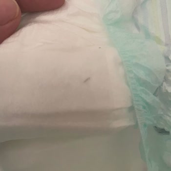 BİM Bebek Bezinde Metal Parça Güvenlik Kontrolü Sorunu