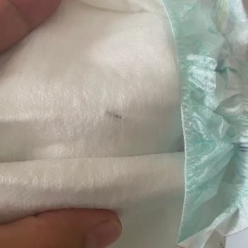 BİM Bebek Bezinde Metal Parça Güvenlik Kontrolü Sorunu