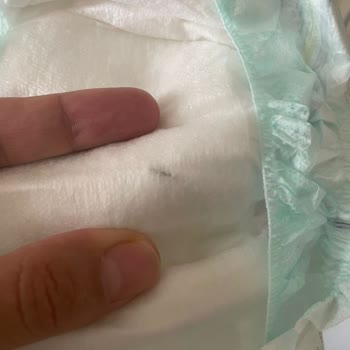 BİM Bebek Bezinde Metal Parça Güvenlik Kontrolü Sorunu