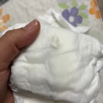 Bebek Bezinde Siyah Sert Madde Sorunu Ve Sağlık Riskleri