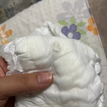 Bebek Bezinde Siyah Sert Madde Sorunu Ve Sağlık Riskleri