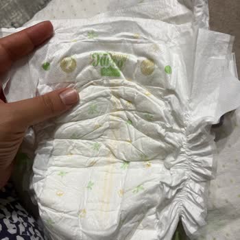 Bebek Bezinde Siyah Sert Madde Sorunu Ve Sağlık Riskleri