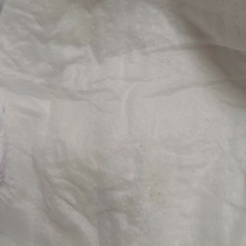 Molfix Bebek Bezinde Sert Cisim Ve Yapışkan Madde: İade Ve Değişim Talebi