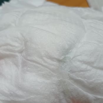 Molfix Bebek Bezinde Sert Cisim Ve Yapışkan Madde: İade Ve Değişim Talebi