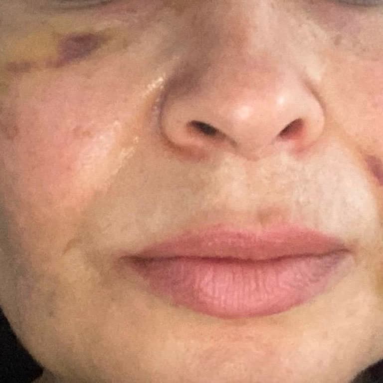 Dr. Nurgül Gökşen Tatmin Edici Bir İlgi Ve Çözüm Sunulmadı