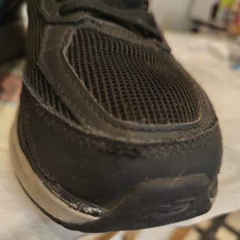 Skechers Ayakkabısının Dikiş Açılması Ve Garanti Sürecinin Şeffaf Olmaması