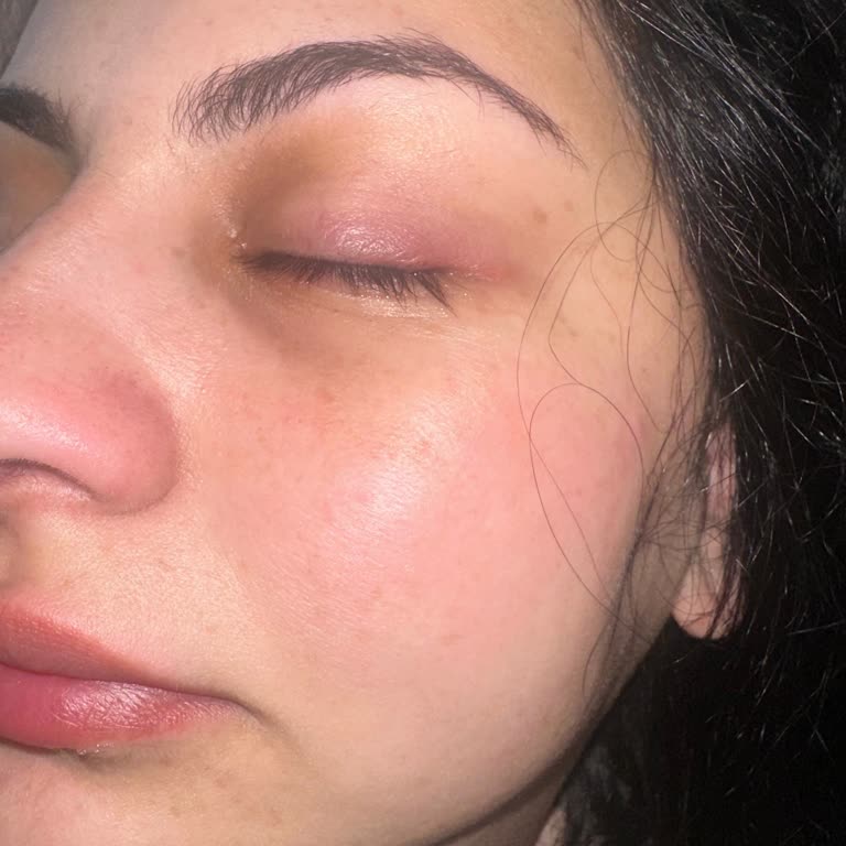 Flormar Longer Maskarasında Göz Arpacığı Oluştu, İade Ve Açıklama Talebi