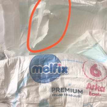 Molfix Bebek Bezlerinde Plastik Kalıntı Sorunu Ve Tekrarlayan Mağduriyet
