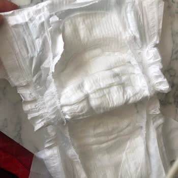 Molfix Bebek Bezlerinde Plastik Kalıntı Sorunu Ve Tekrarlayan Mağduriyet