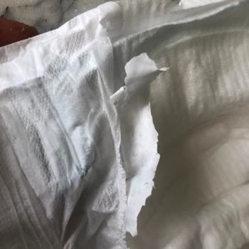 Molfix Bebek Bezlerinde Plastik Kalıntı Sorunu Ve Tekrarlayan Mağduriyet