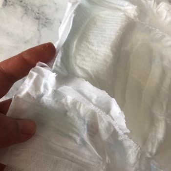 Molfix Bebek Bezlerinde Plastik Kalıntı Sorunu Ve Tekrarlayan Mağduriyet