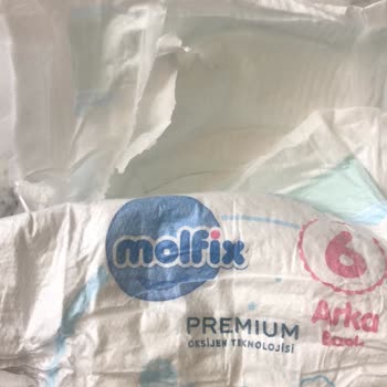 Molfix Bebek Bezlerinde Plastik Kalıntı Sorunu Ve Tekrarlayan Mağduriyet