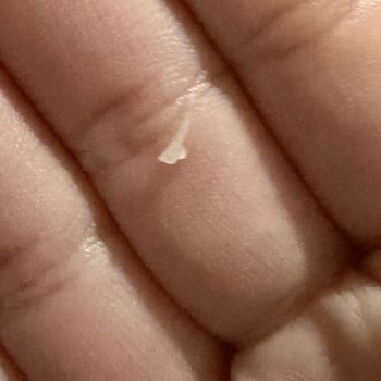 Algida Cornetto Disc Vanilya Karamel Dondurmasında Keskin Plastik Parça Çıktı