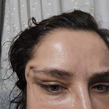 Op. Dr. Duygu Aksoy Vaat Edilen İşlemin Yapılmaması, Yaşadığım Sağlık Sorunları ve Boşa Giden Para