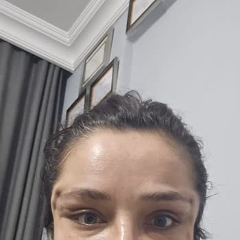 Op. Dr. Duygu Aksoy Vaat Edilen İşlemin Yapılmaması, Yaşadığım Sağlık Sorunları ve Boşa Giden Para