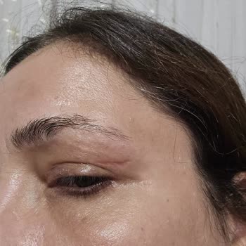 Op. Dr. Duygu Aksoy Vaat Edilen İşlemin Yapılmaması, Yaşadığım Sağlık Sorunları ve Boşa Giden Para
