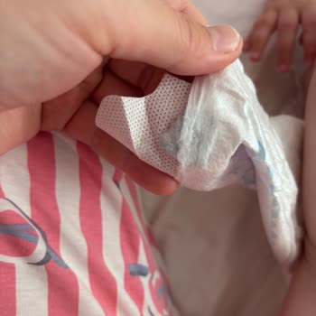 Molfix Bebek Bezinde Bant Açılma Sorunu Ve Yabancı Madde Bulunması Nedeniyle İade Talebi