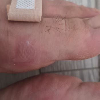 Boyner'den Aldığım Ayakkabı Mezuniyet Gecesinde Ayağımı Yanık Duruma Sürükledi