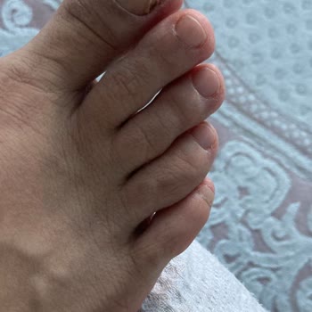 Cerenil Beauty Hem Saç Kesimi Hem De Pedikür İşlemi Son Derece Özensiz Ve Hatalı Yapıldı