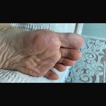 Cerenil Beauty Hem Saç Kesimi Hem De Pedikür İşlemi Son Derece Özensiz Ve Hatalı Yapıldı