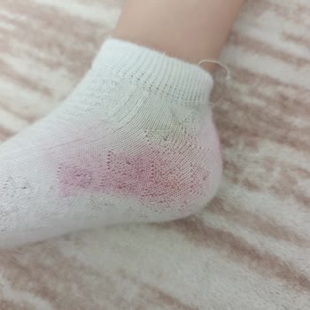Vicco Kız Çocuk Sandaletinde Boya Verdiği İçin İade Ve Değişim Talebi