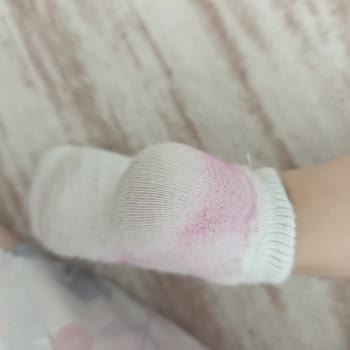 Vicco Kız Çocuk Sandaletinde Boya Verdiği İçin İade Ve Değişim Talebi