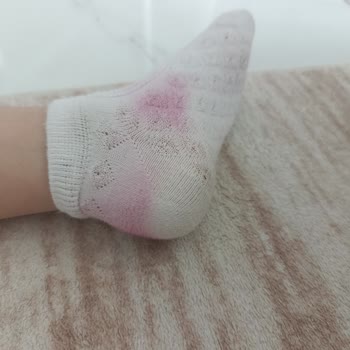 Vicco Kız Çocuk Sandaletinde Boya Verdiği İçin İade Ve Değişim Talebi