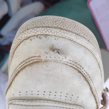 2 Yıllık Garanti Kapsamındaki Reebok Ayakkabımda Erken Bozulma Ve Garanti Reddi