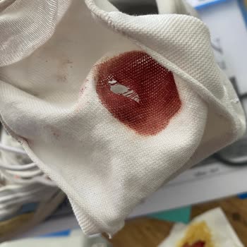 Adidas Ozelia Ayakkabısının Dayanıksız Tabanı Ayak Yaraladı